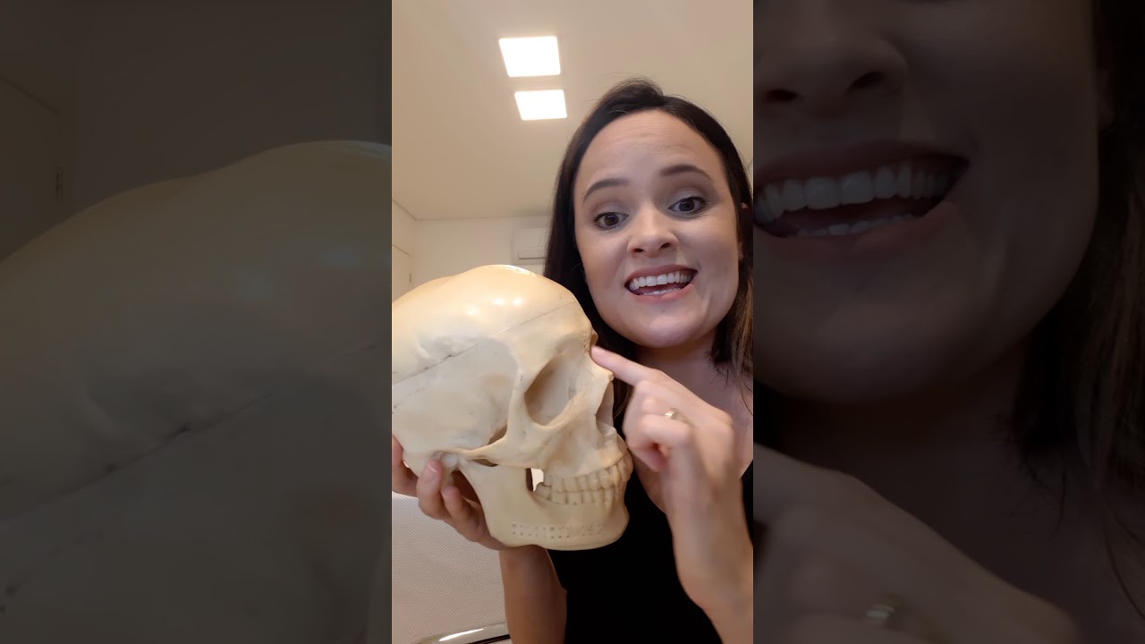COMO É A CIRURGIA DE FRATURA DE FACE - DRA JULIANA MEDEIROS
