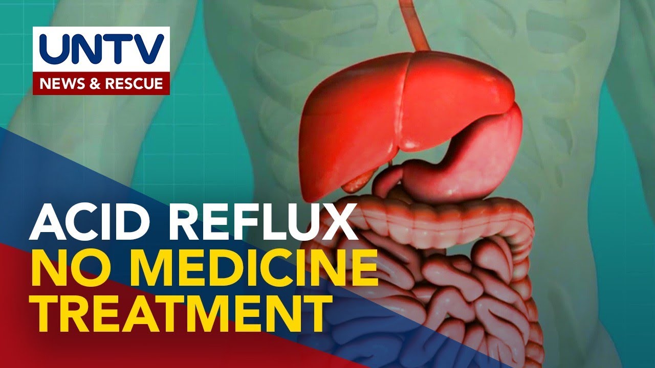 ALAMIN: Paglaban sa Acid Reflux ng Walang Iniinom na Gamot