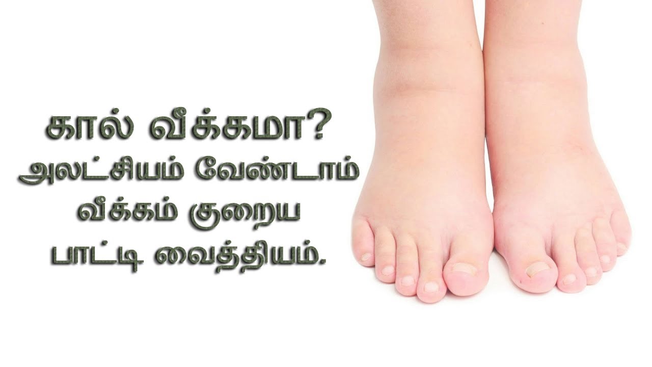 கால் வீக்கம் உடனே நீங்க | home remedies for swelling of leg