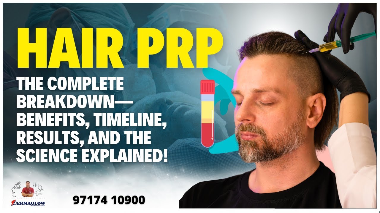 Hair PRP: Complete Breakdown – Benefits, Timeline, Results & Science Explained! Dr. Santpal Sangwan