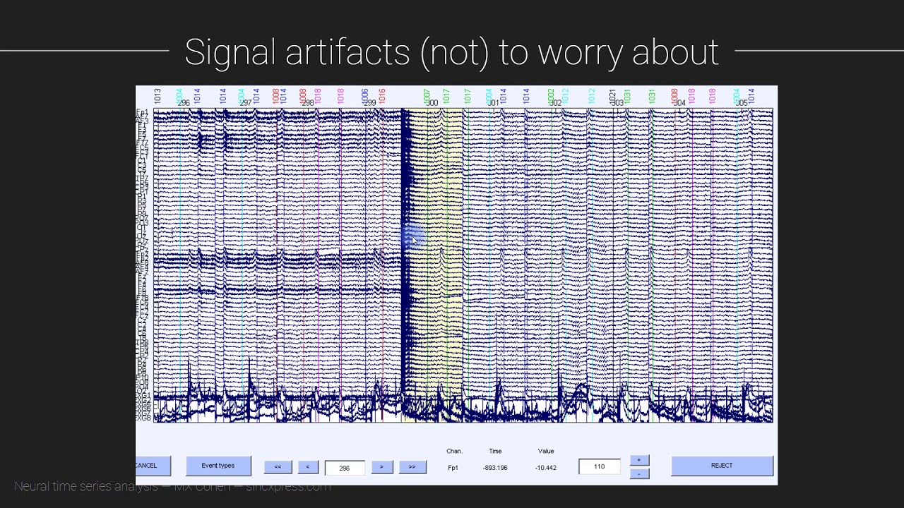 Signal artifacts (not) to worry about