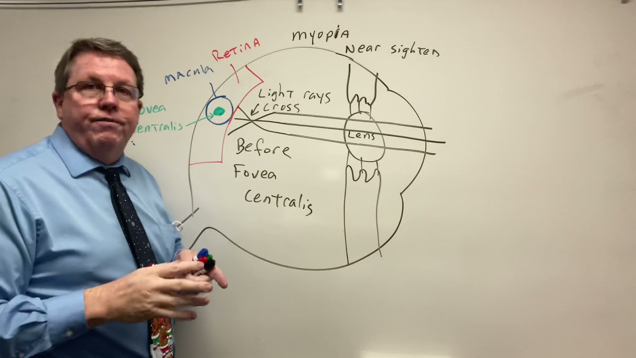 Nearsightedness, Farsightedness and Normal Vision Explained so you can understand