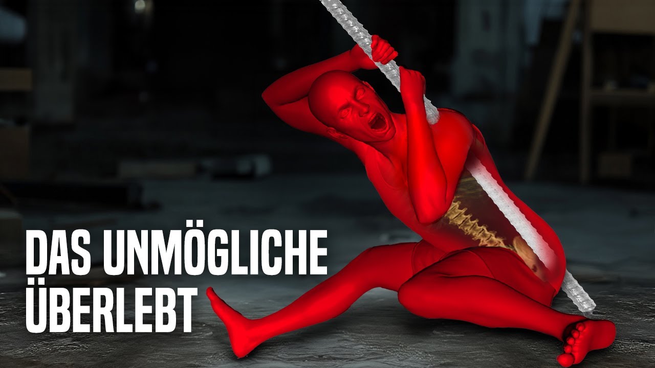 Die gruseligsten Arbeitsunf&auml;lle
