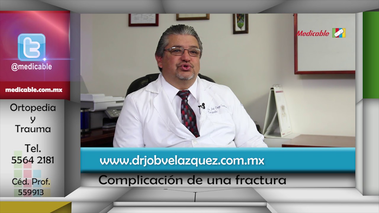 ¿Cómo saber si hay complicaciones en una fractura?