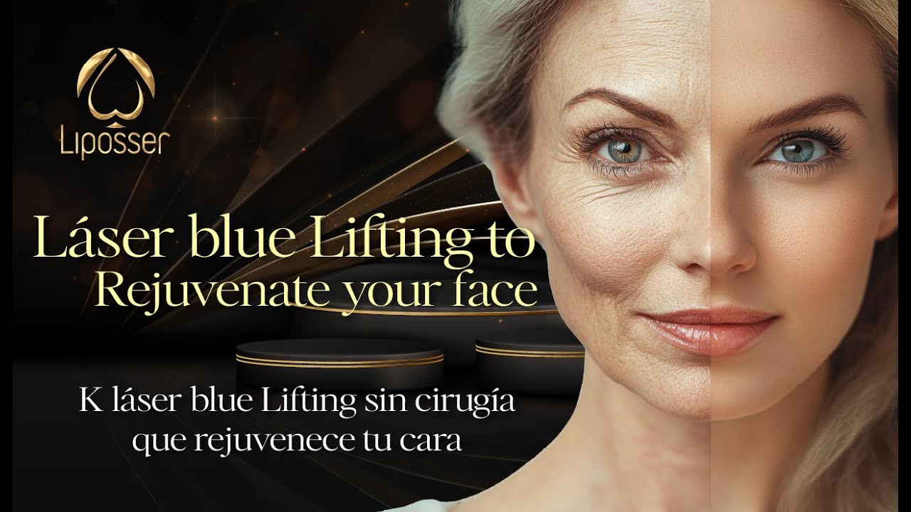 K Laser Blue lifting, rejuvenece tu cara sin cirugía.