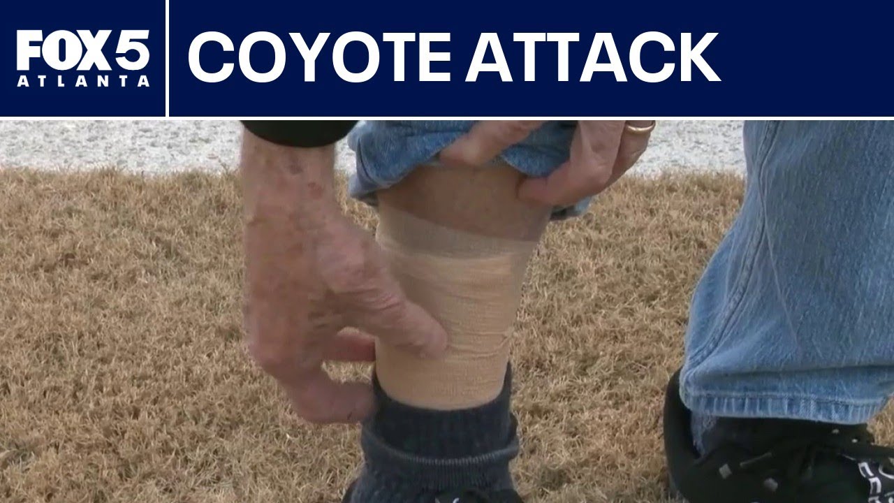 Man survives coyote attack | FOX 5 News