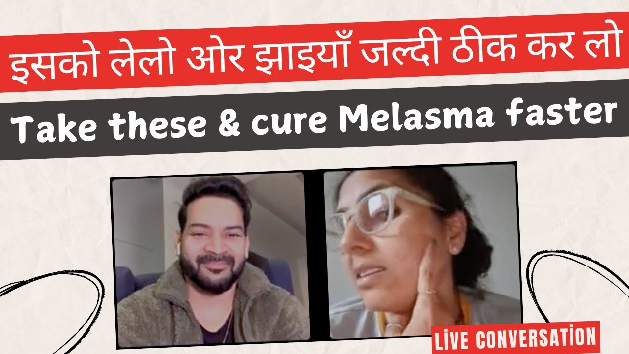 इसको लेलो ओर झाइयाँ जल्दी ठीक कर लो II Take these and heal your Melasma faster