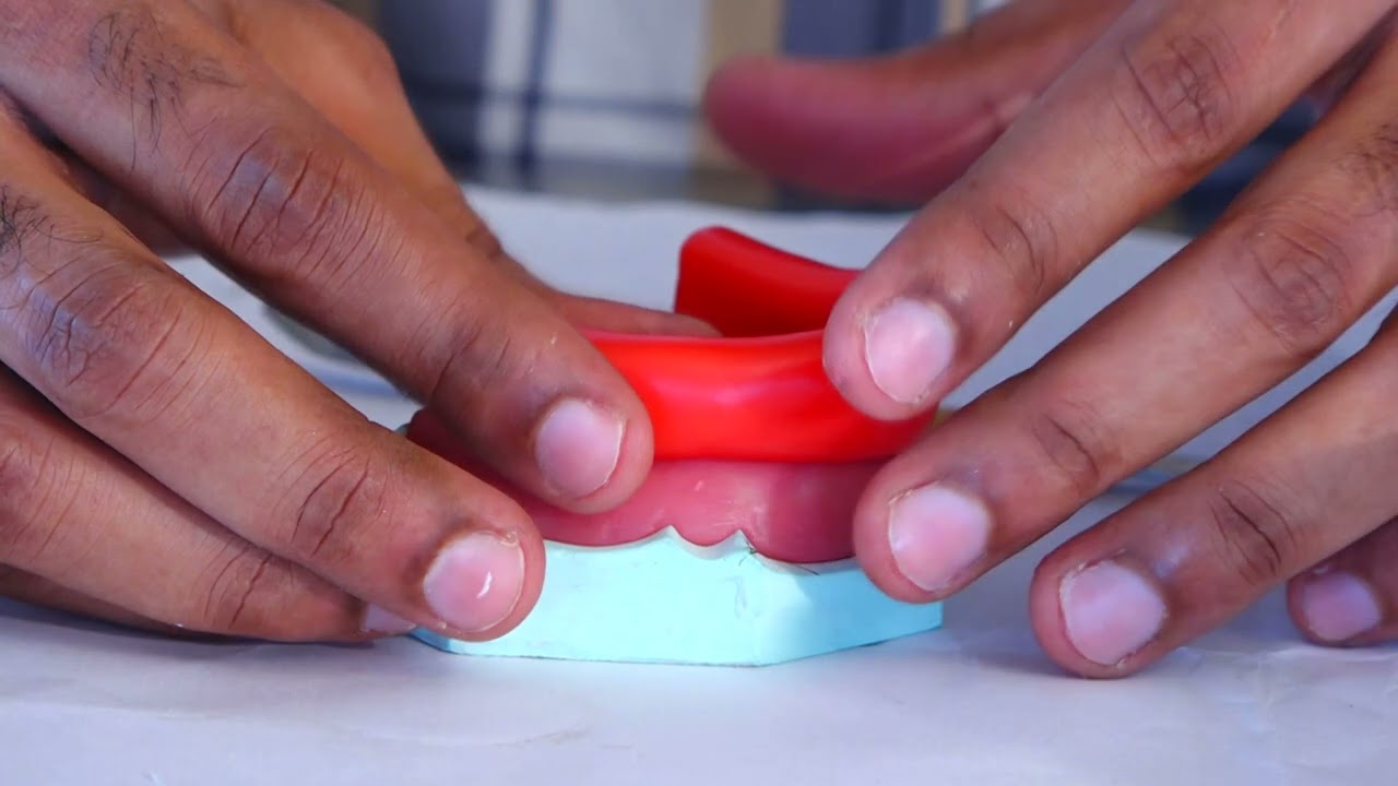 Prosthodontics - Fabrication of Occlusal Rims
