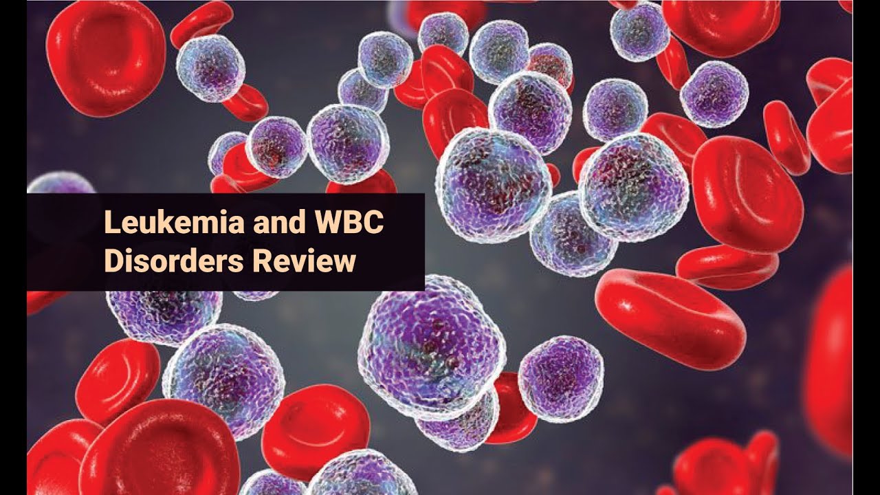 Leukemia and wbc disorders review