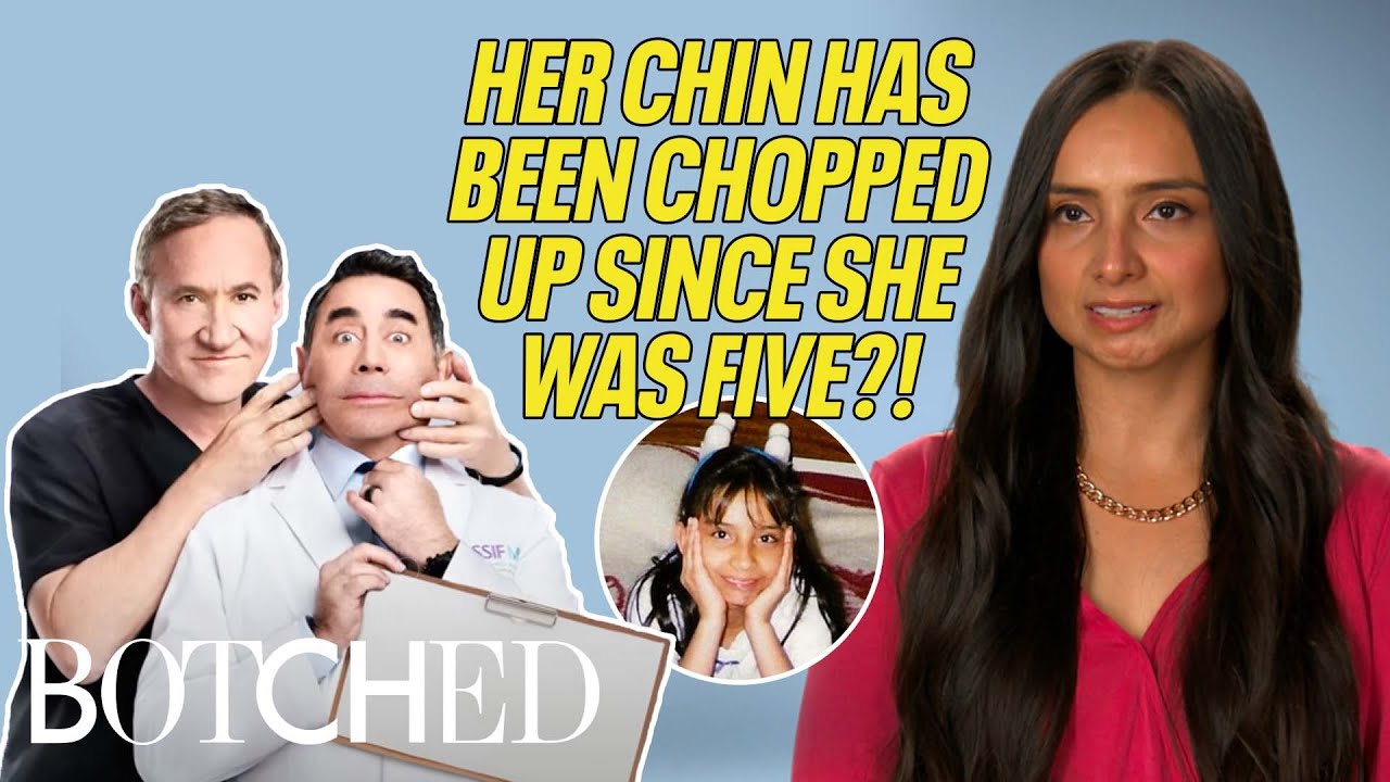 Yazmin Ran Into A Wall At 5 Years Old?! (Before & After) | Botched | E!