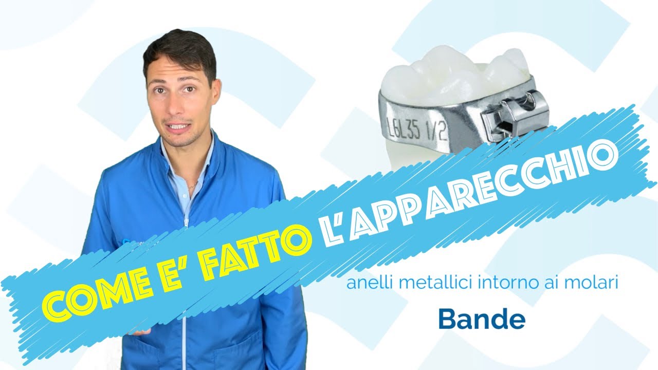 Come è fatto l'apparecchio? Quali sono le parti che lo compongono?