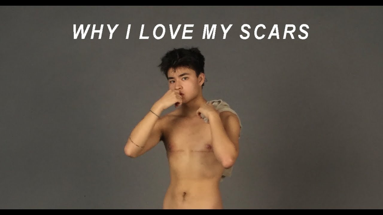 WHY I LOVE MY SCARS