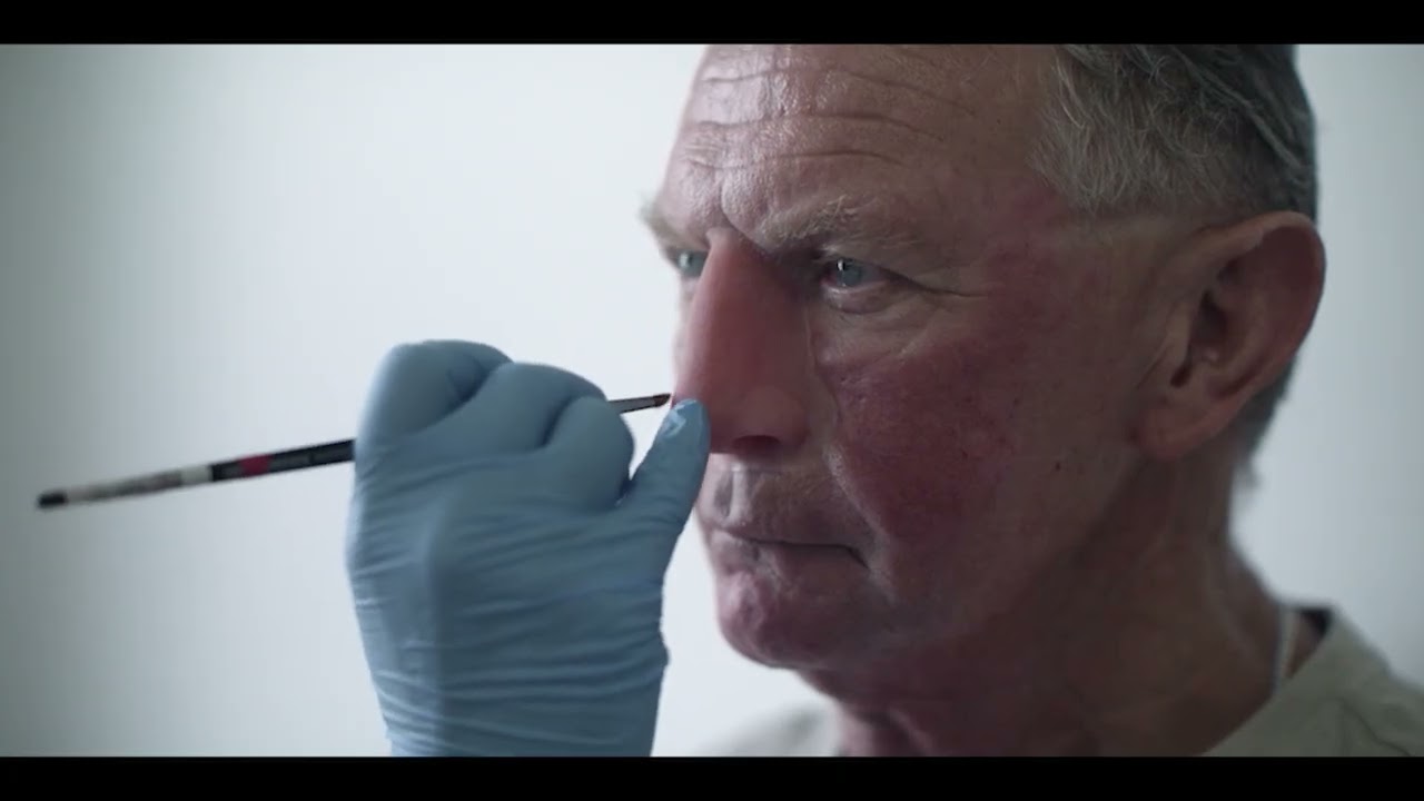 Introduction to Facial Prosthetics for Head and Neck Cancer patients
