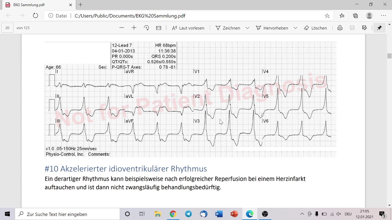 Wir befunden live EKGs (20.00 Uhr)