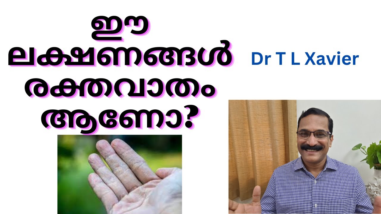 Is it a early Arthritis Sign You May Prevent Now