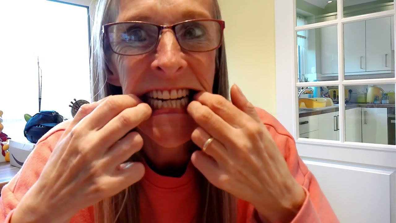 NEW DENTURES REVEAL!! At last!