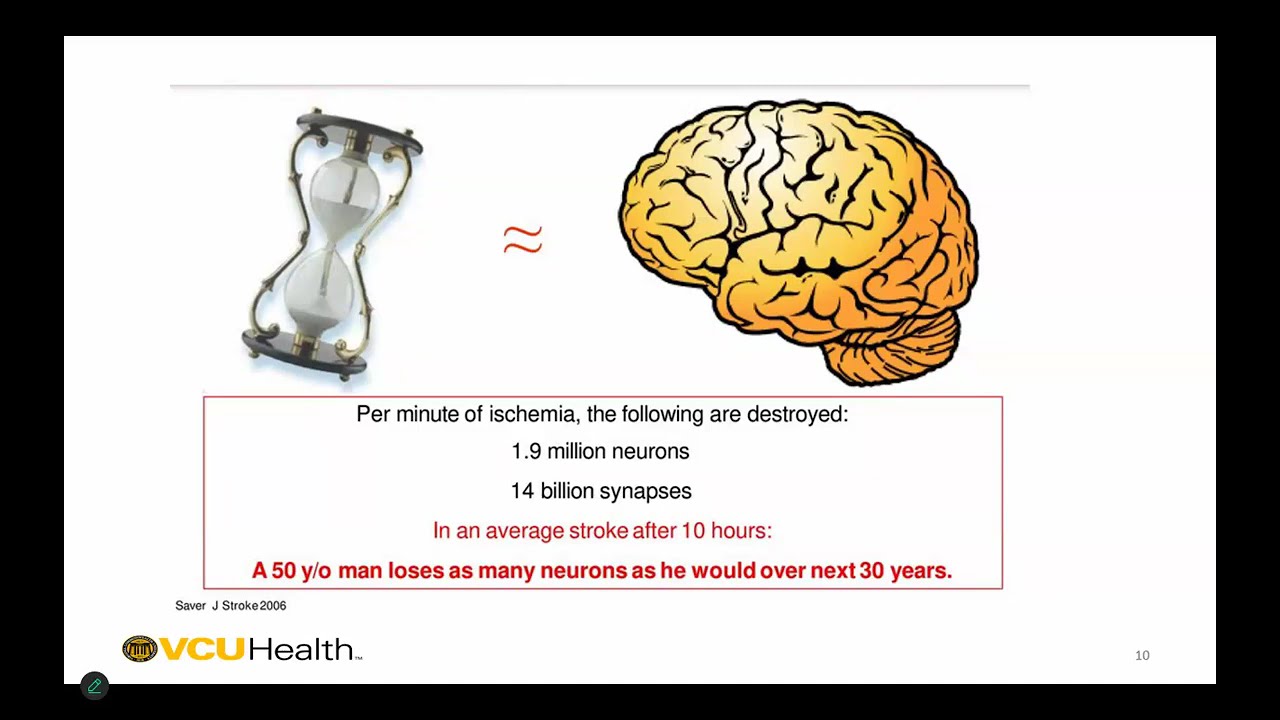 DOIM GR 11/21/24: Acute Stroke Management