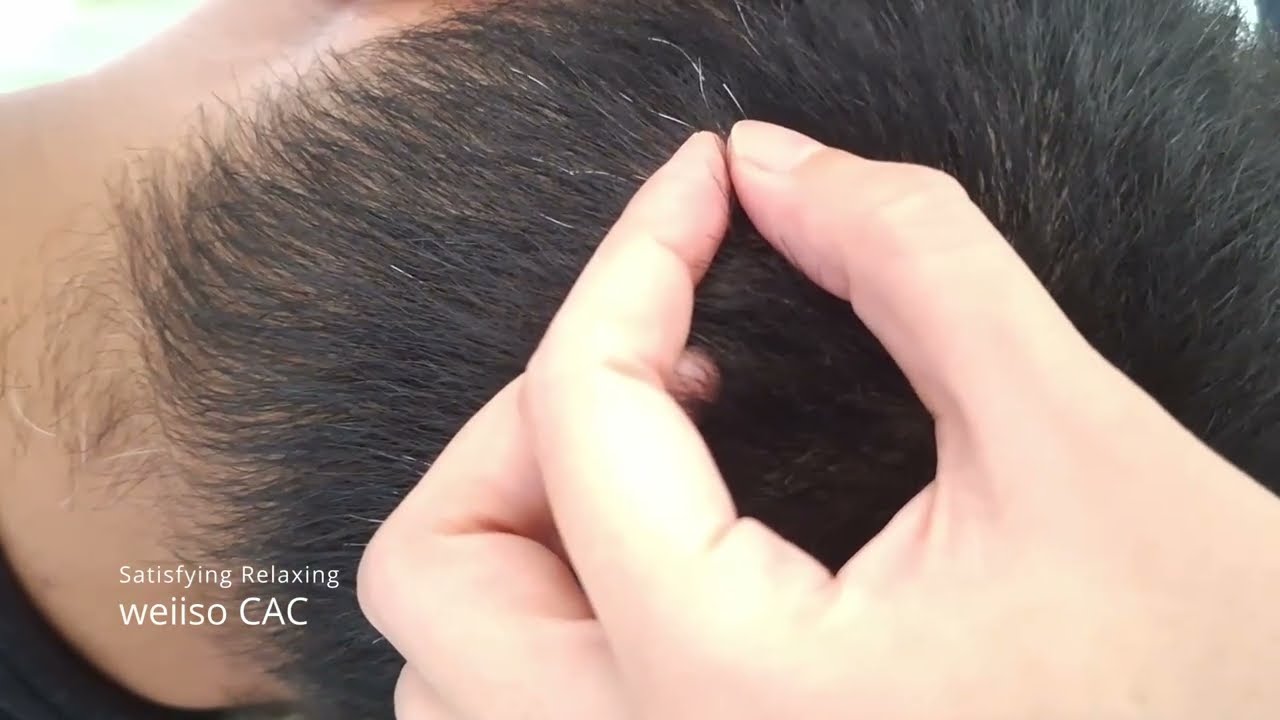 Satisfying Relaxing Cabut Uban #21
