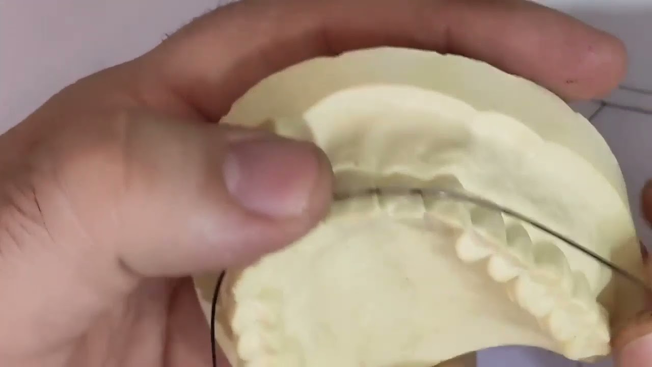 first order bend