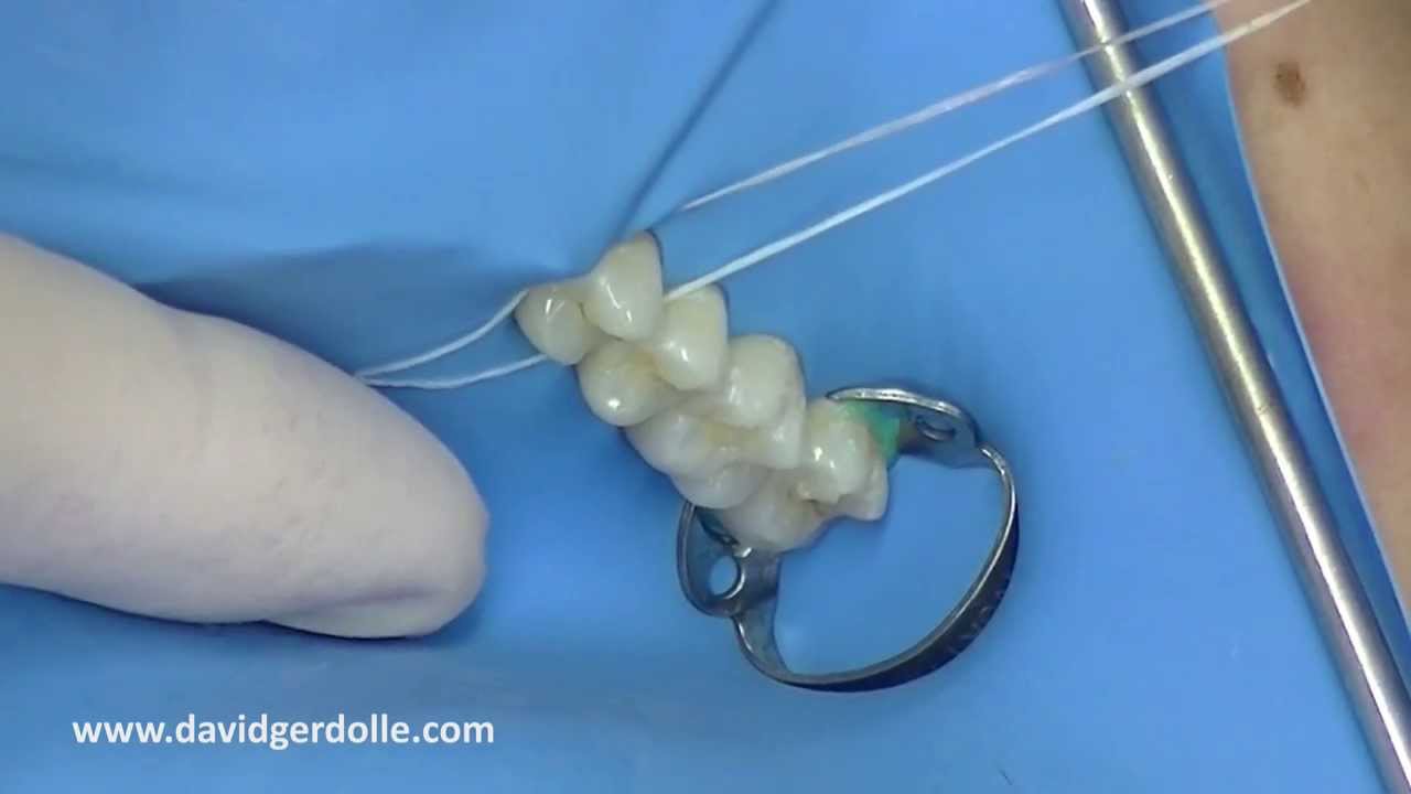 dental dam and posterior teeth