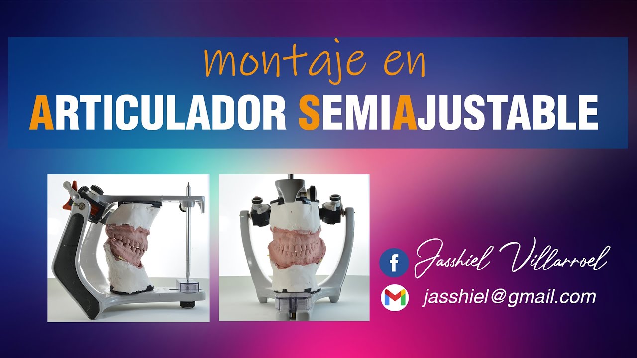 MONTAJE EN ARTICULADOR SEMIAJUSTABLE
