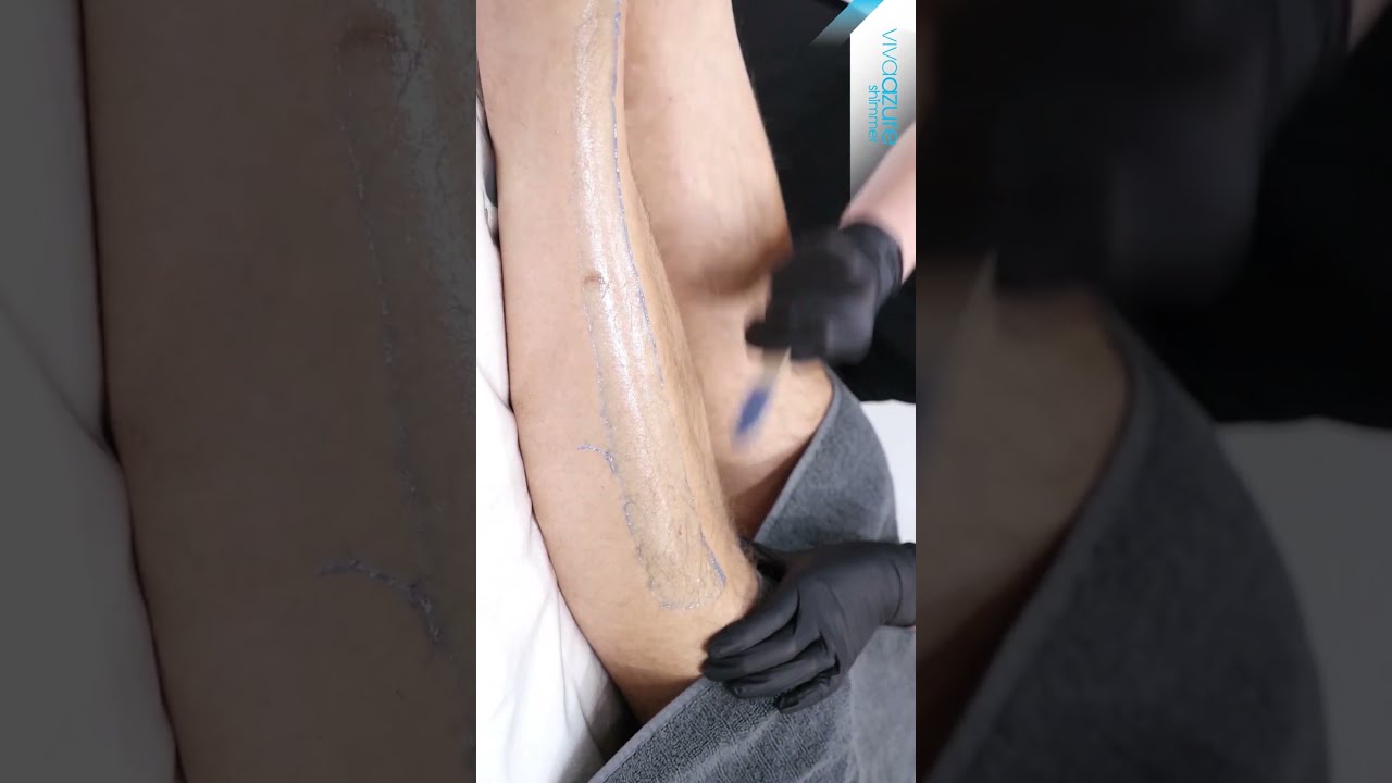 Caronlab - Viva Azure Wax on Legs