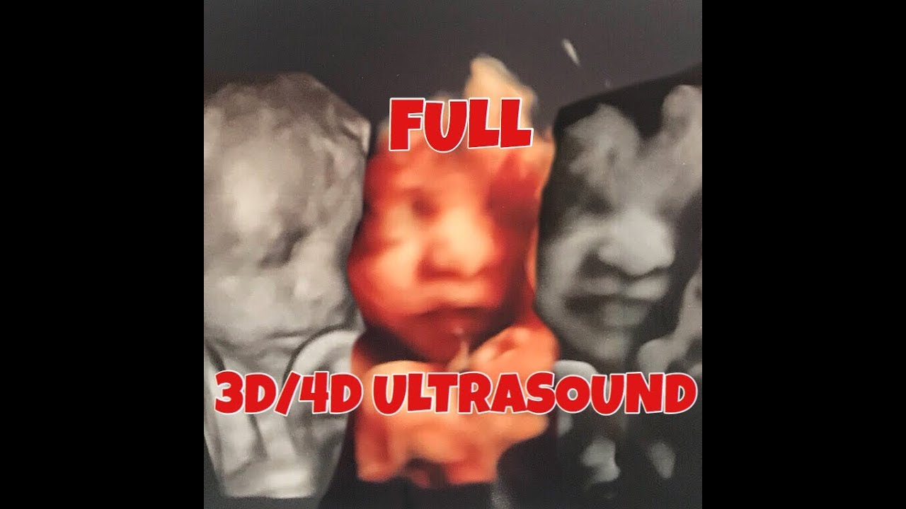 OUR FULL 3D/4D ULTRASOUND!!! | 31 WEEKS PREGNANT