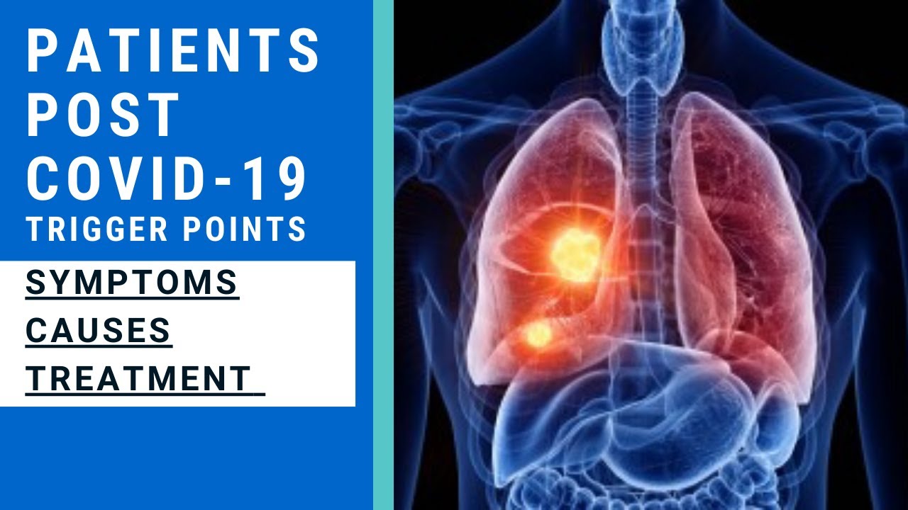 Post Covid-19 Trigger Points Treatment - How to Treat Chest Pains & Other Muscles