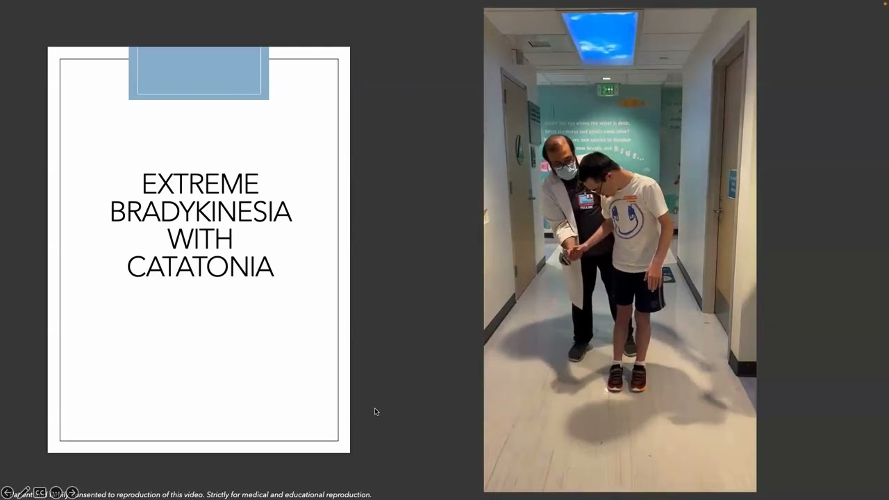 Down Syndrome Regression Disorder