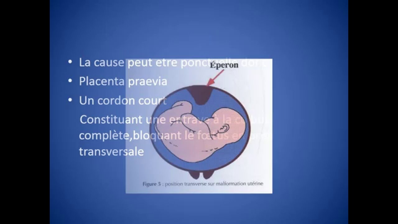 GYNECOLOGIE Présentation transverse