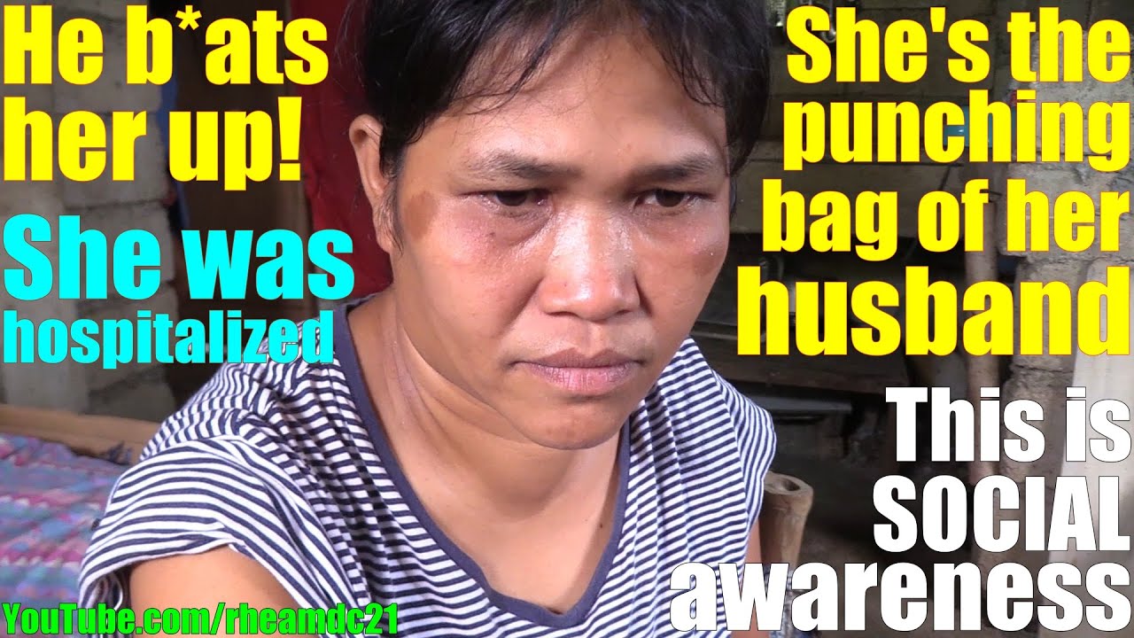 Are Filipino Men Abusive, Hurtful and Sadists? This Filipina Woman was a Victim of Hit and Run. PH
