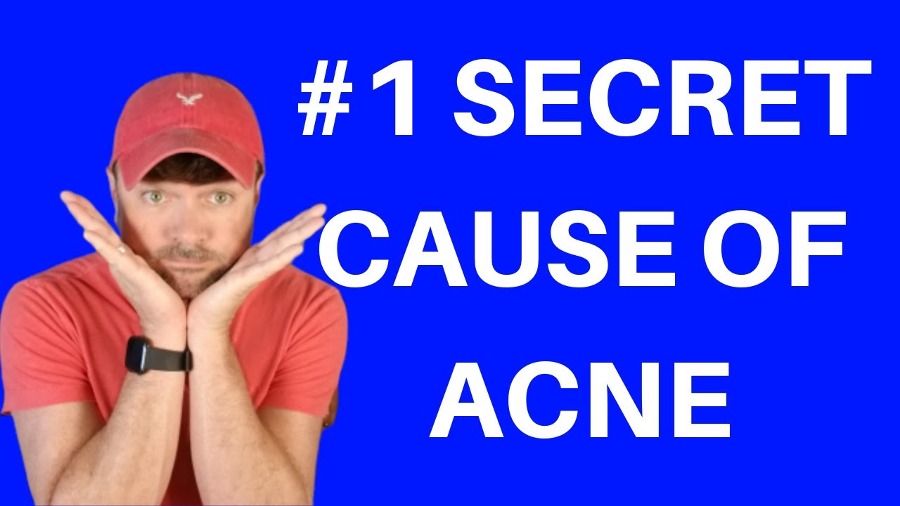 Acne And Inflammation (Stopping Acne Breakouts At The Cause)