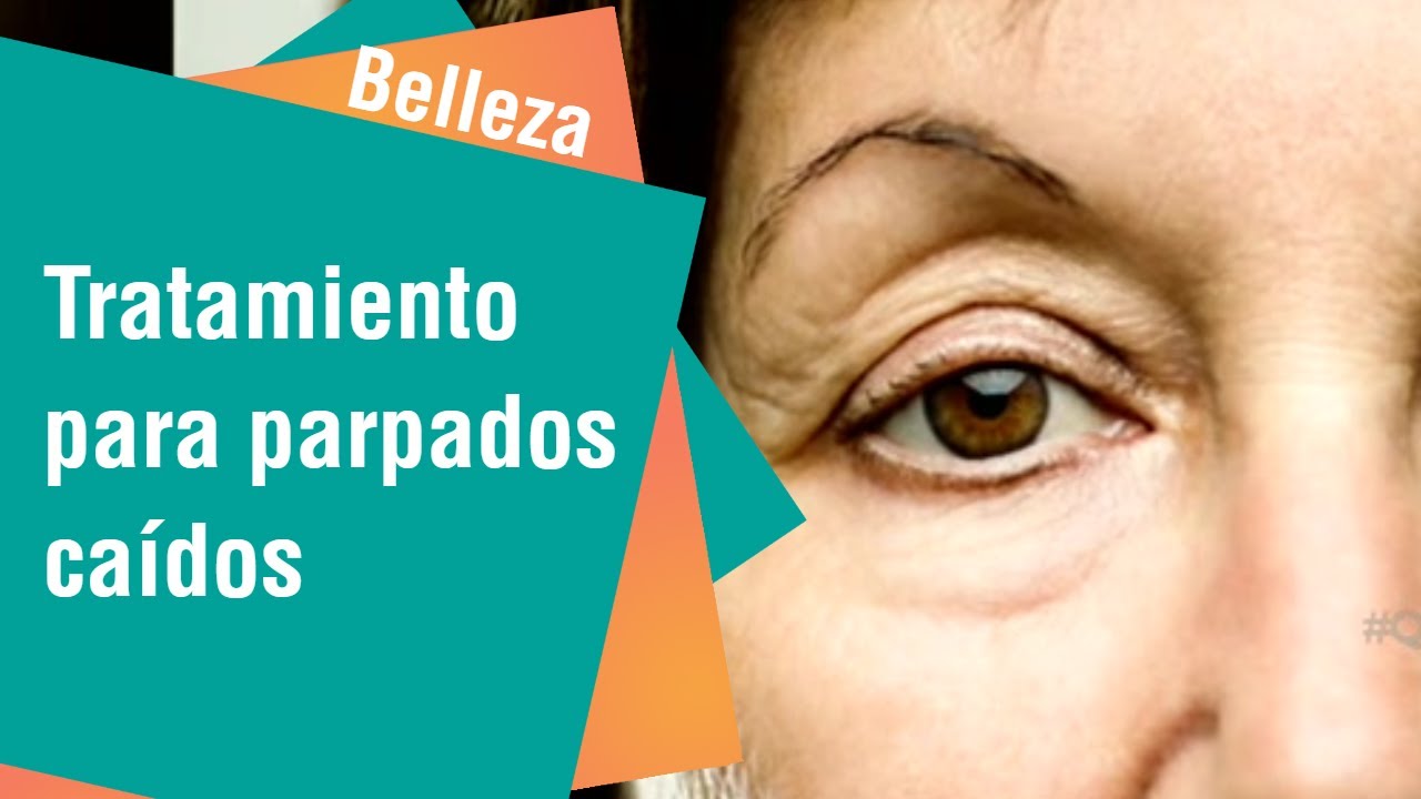 C&oacute;mo sacar el exceso de piel de los p&aacute;rpados sin bistur&iacute; | Belleza