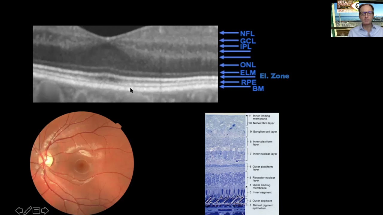 Videolezione eredodistrofie retiniche