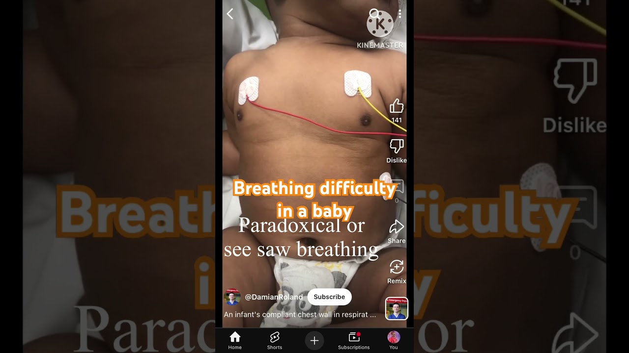 Atembeschwerden bei einem Baby