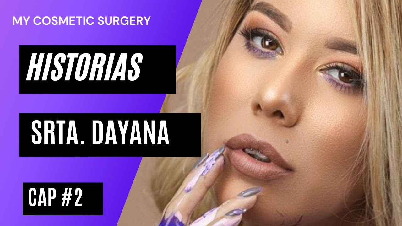 Srta. Dayana en My Cosmetic Surgery CAP #2