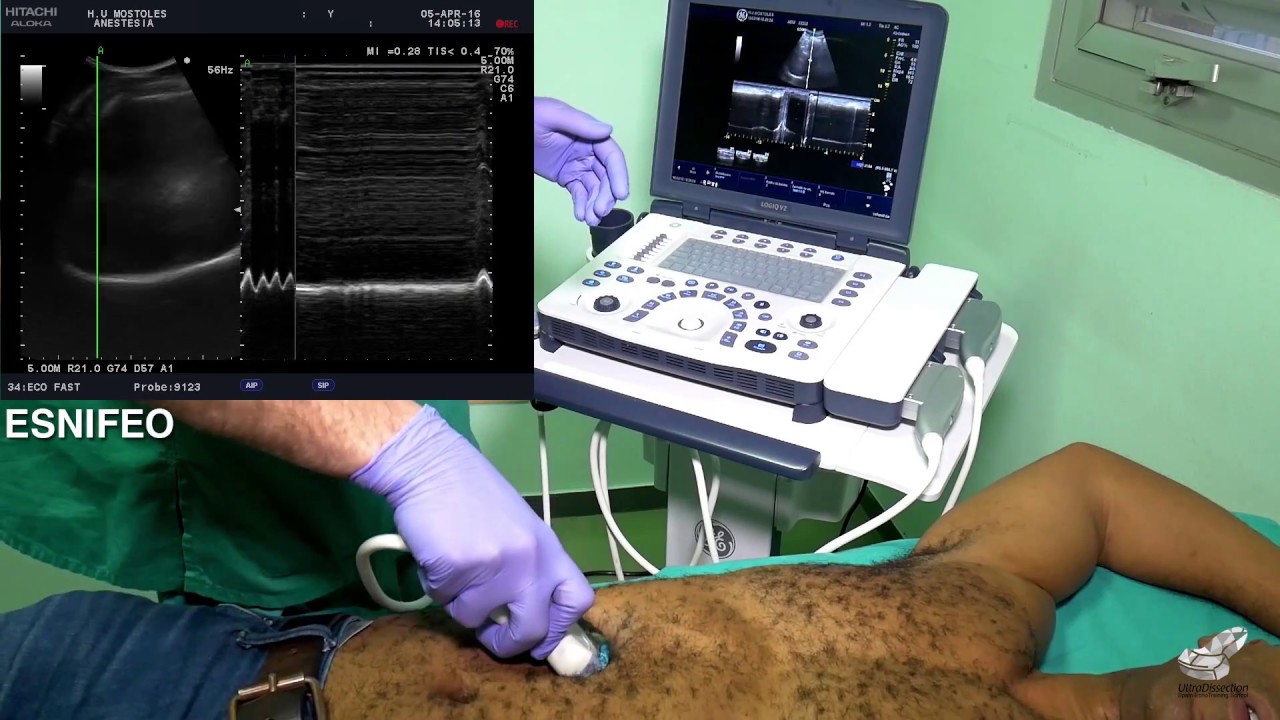 Ecografía pulmonar y diafragmática/Lung ultrasound