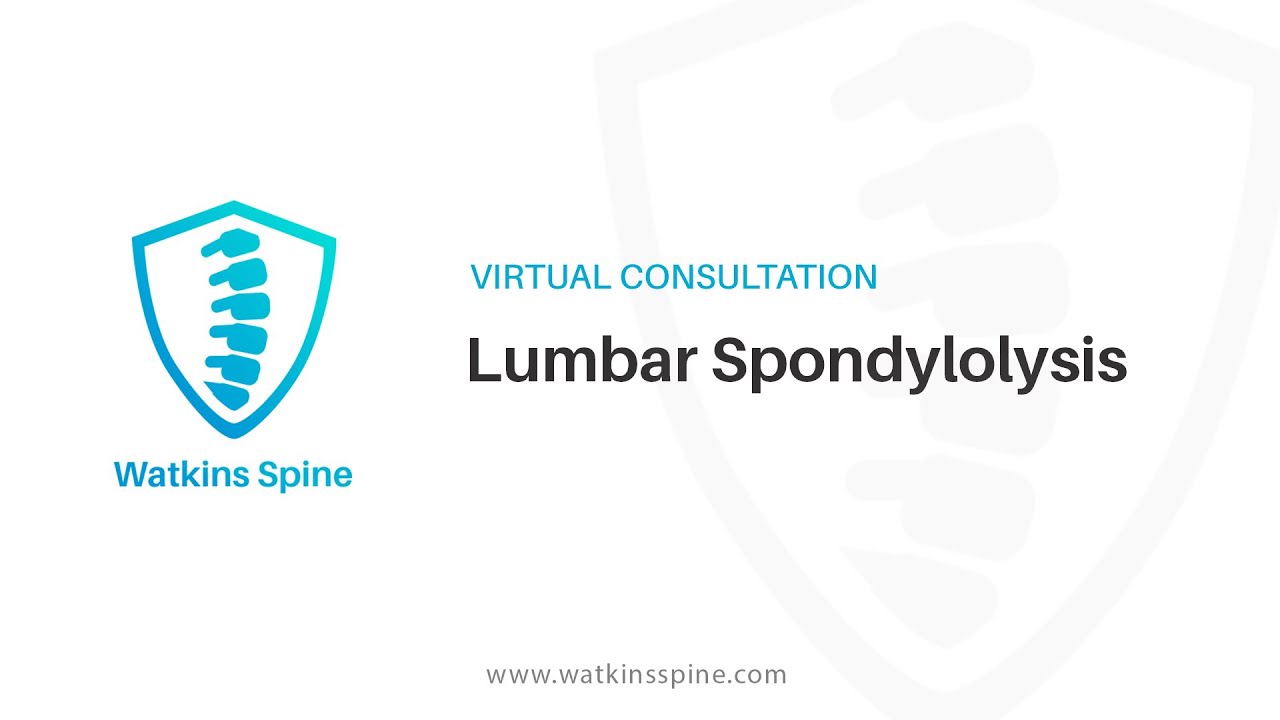 Lumbar Spondylolysis - Virtual Consultation with Dr. Robert Watkins IV