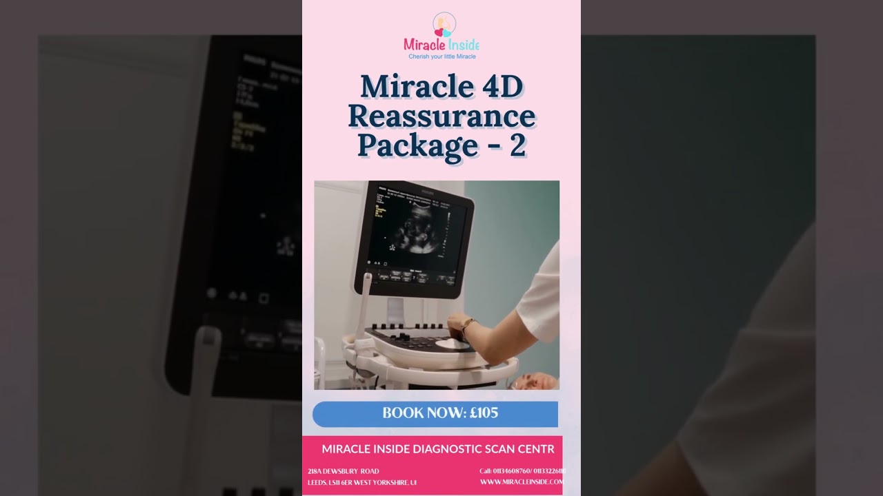 Bond with Baby Early - 4D Reassurance Scan 2