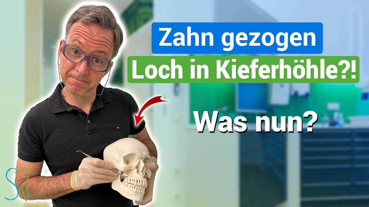 Loch in der  Kieferhöhle nach Zahnextraktion- die Mund Antrum Verbindung