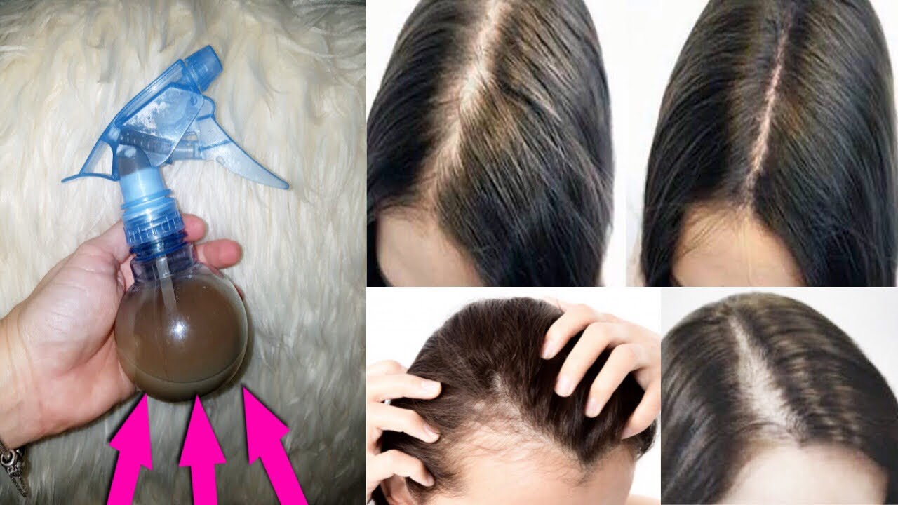 CABELO CRECE MUITO RÁPIDO E PARA DE CAIR!