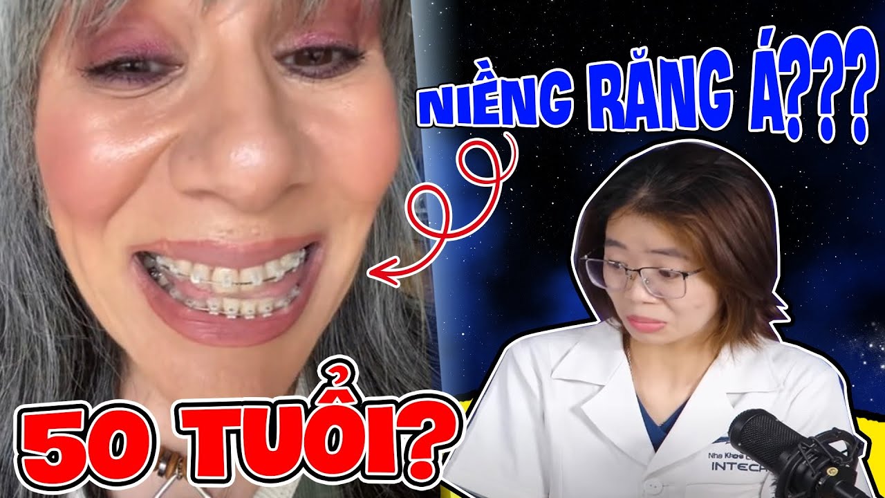 Thời Gian Niềng Răng: Thời Gian Niềng Răng Người Lớn Có Tốn Nhiều Thời Gian "Như Lời Đồn"?
