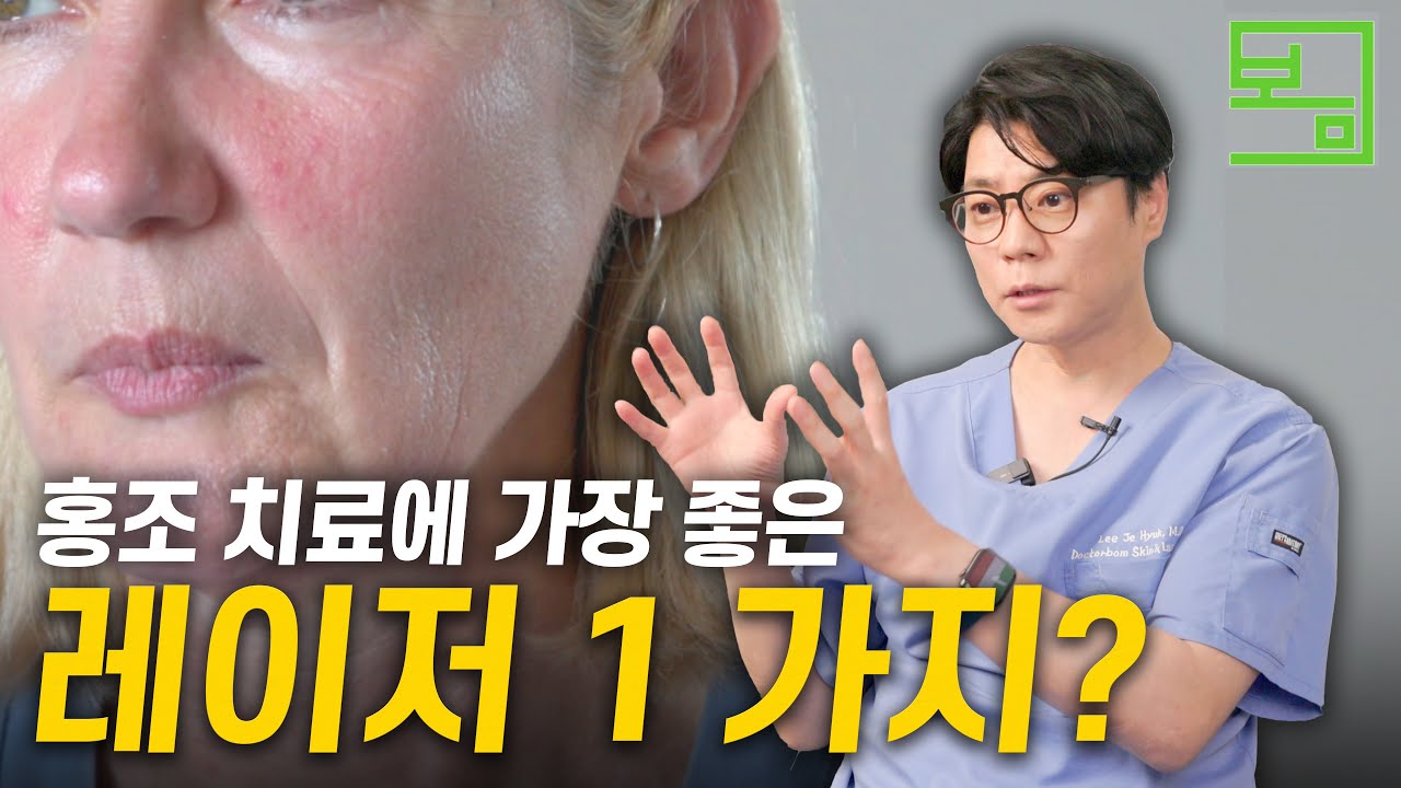 안면홍조 치료에 가장 좋은 레이저?