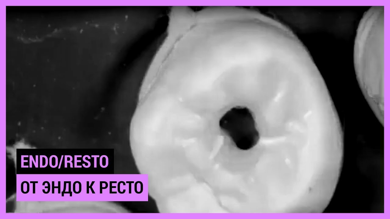 Endo/Resto course with only focus on practice. От Эндо к Ресто