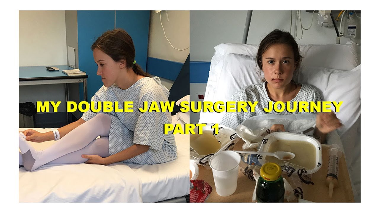 My Double Jaw Surgery Journey Part.1