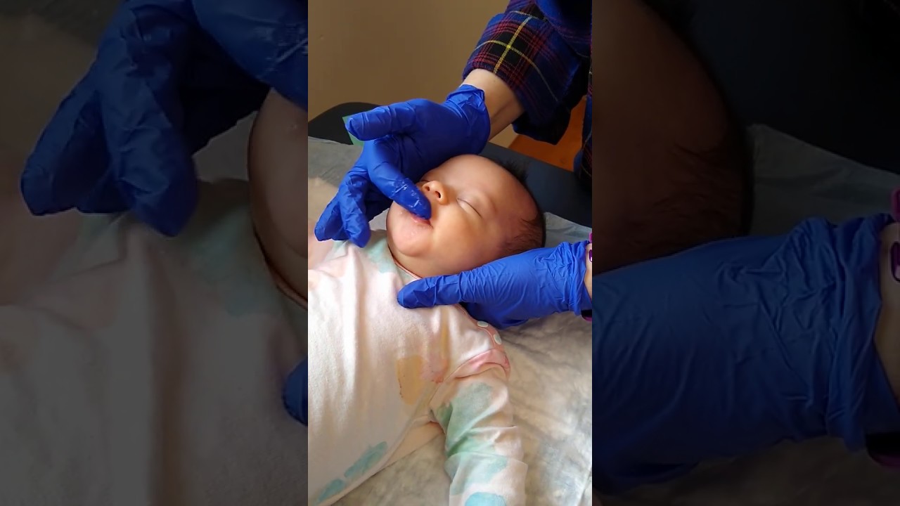 Frenotomy After Care Exercises
