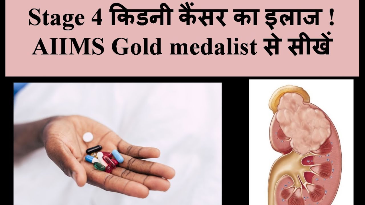 स्टेज 4 किडनी कैंसर का इलाज इन हिंदी 2018: DM(AIIMS) Stage 4 kidney cancer treatment hindi