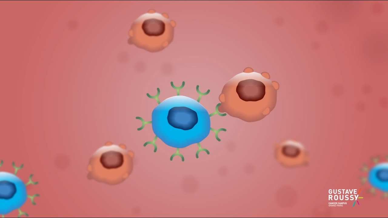 Le parcours de soins CAR - T CELLS à Gustave Roussy