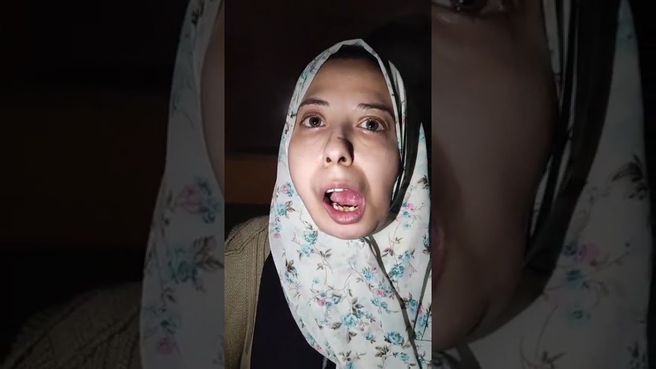 وقـ ـعت من مرجيحة وعملت 12 عملية جـ،راحية .. شوق قصتها اغرب من الخيال في الاسماعيلية .. بث مباشر