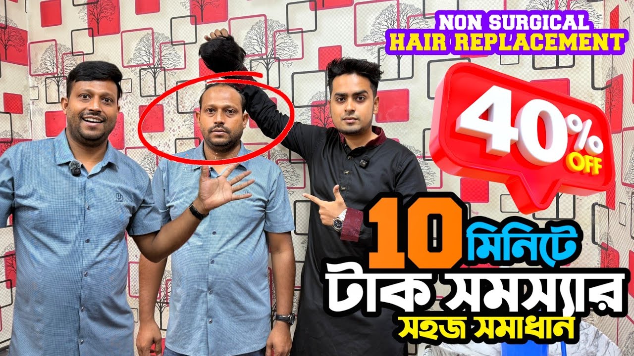 ১০ মিনিটে টাক সমস্যার সহজ সমাধান,hair replacement in BD, non surgical hair replacement, আলগা চুল দাম